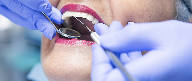 Best Broken or Chipped Tooth Repair in Wailua, HI